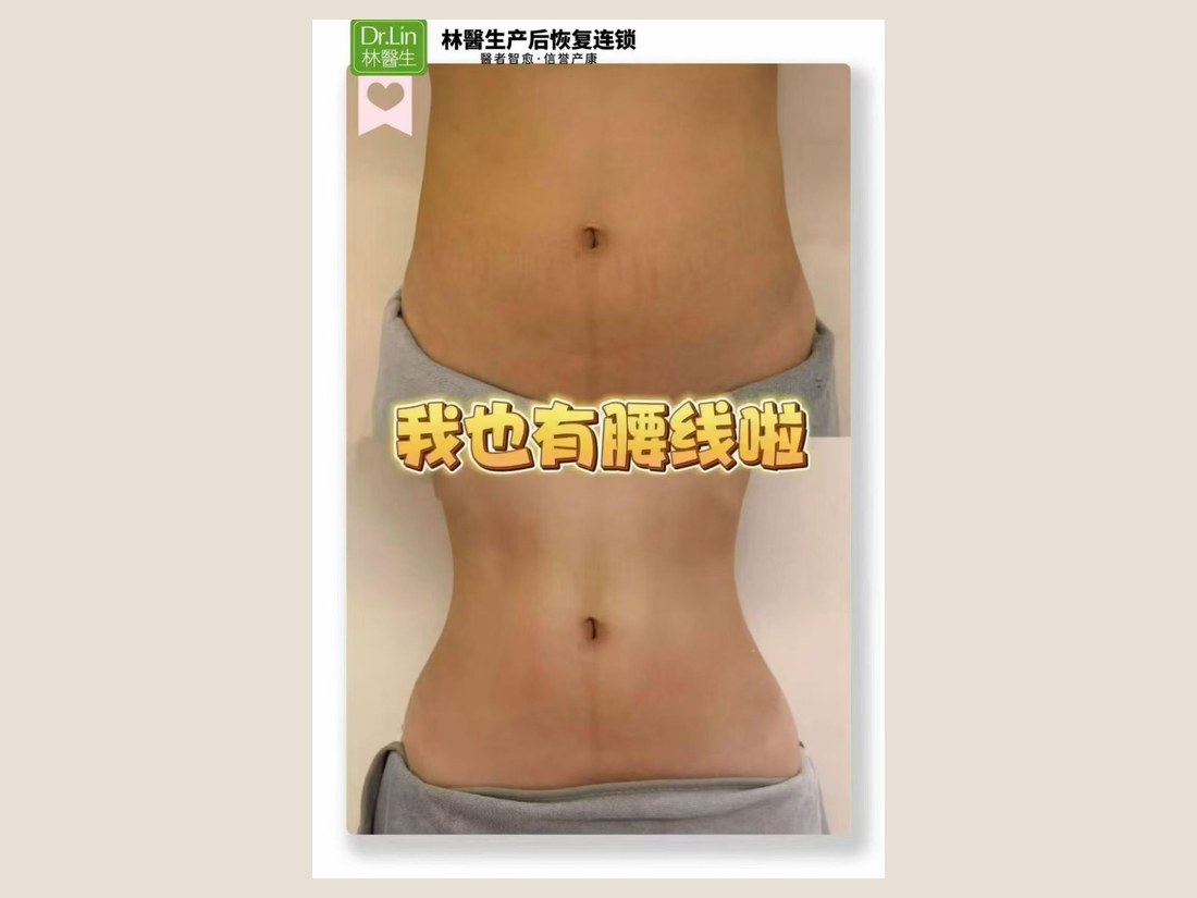 身材管理科部客户案例:我也有腰线啦