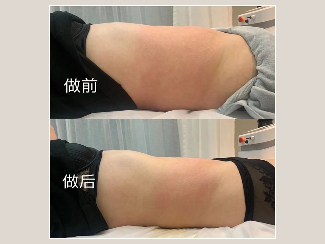 身材管理科部客户案例:GF 标准化细胞纤体