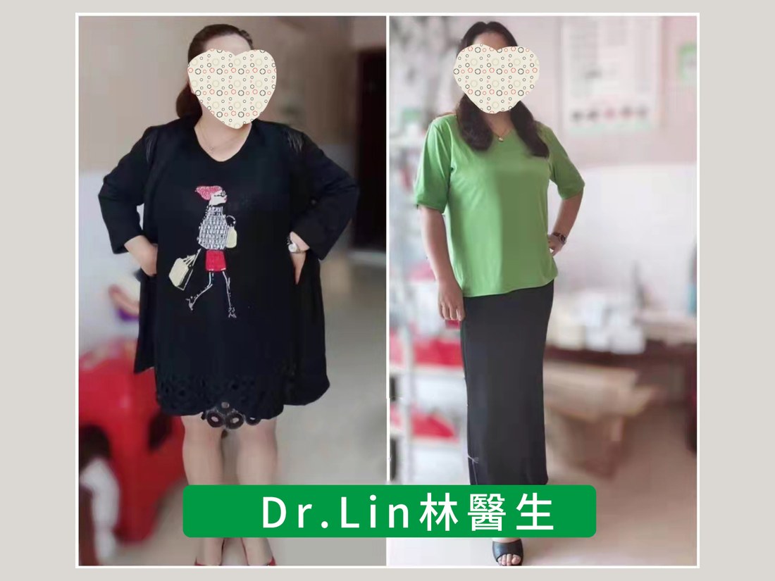 身材管理科部客户案例:产后体型调理前后对照