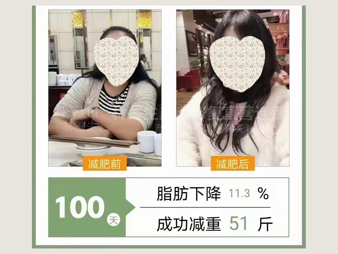 身材管理科部客户案例:100 天减重 51 斤