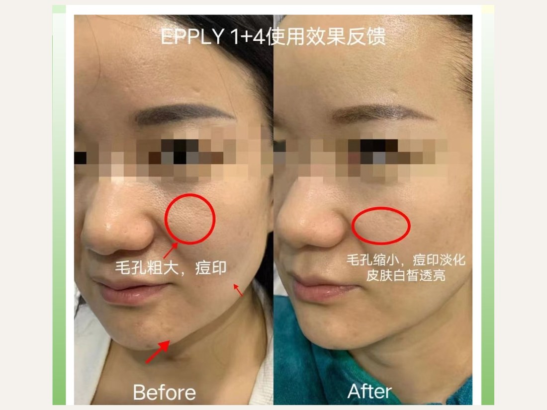 科技美肤部客户案例:基底再生