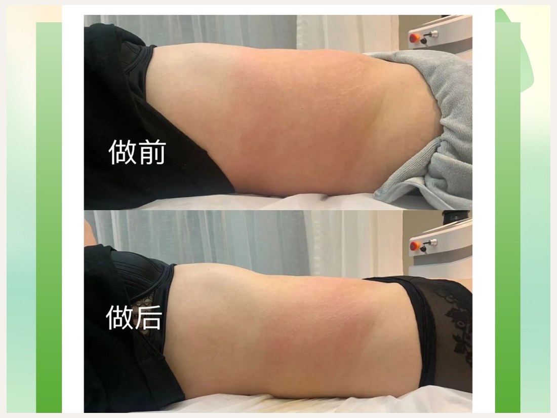 身材管理科部客户案例:GF 标准化细胞纤体