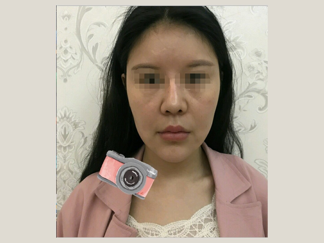 科技美肤部客户案例:面部状态实拍