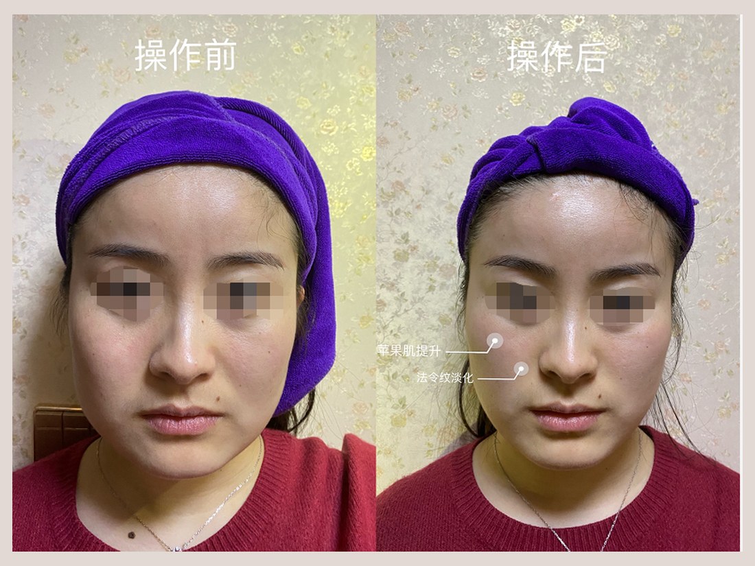 科技美肤部客户案例:操作前后对照