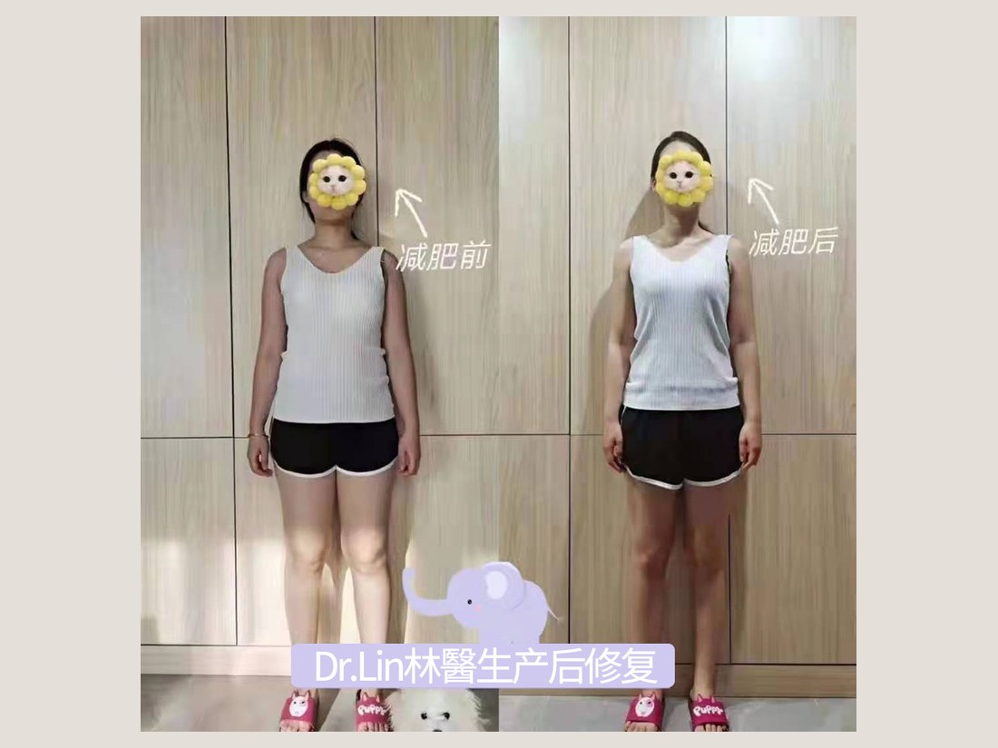 身材管理科部客户案例:体重形体管理记录