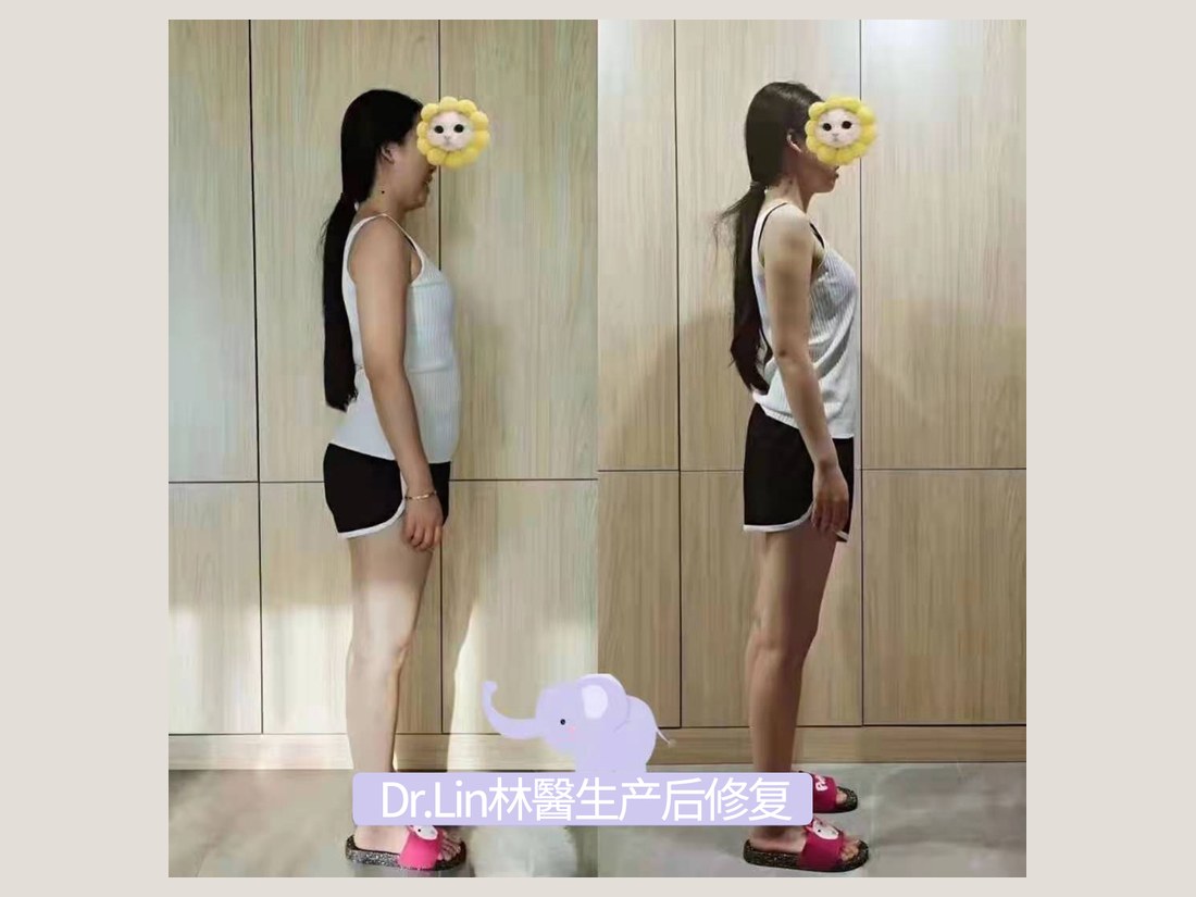 身材管理科部客户案例:体态管理记录