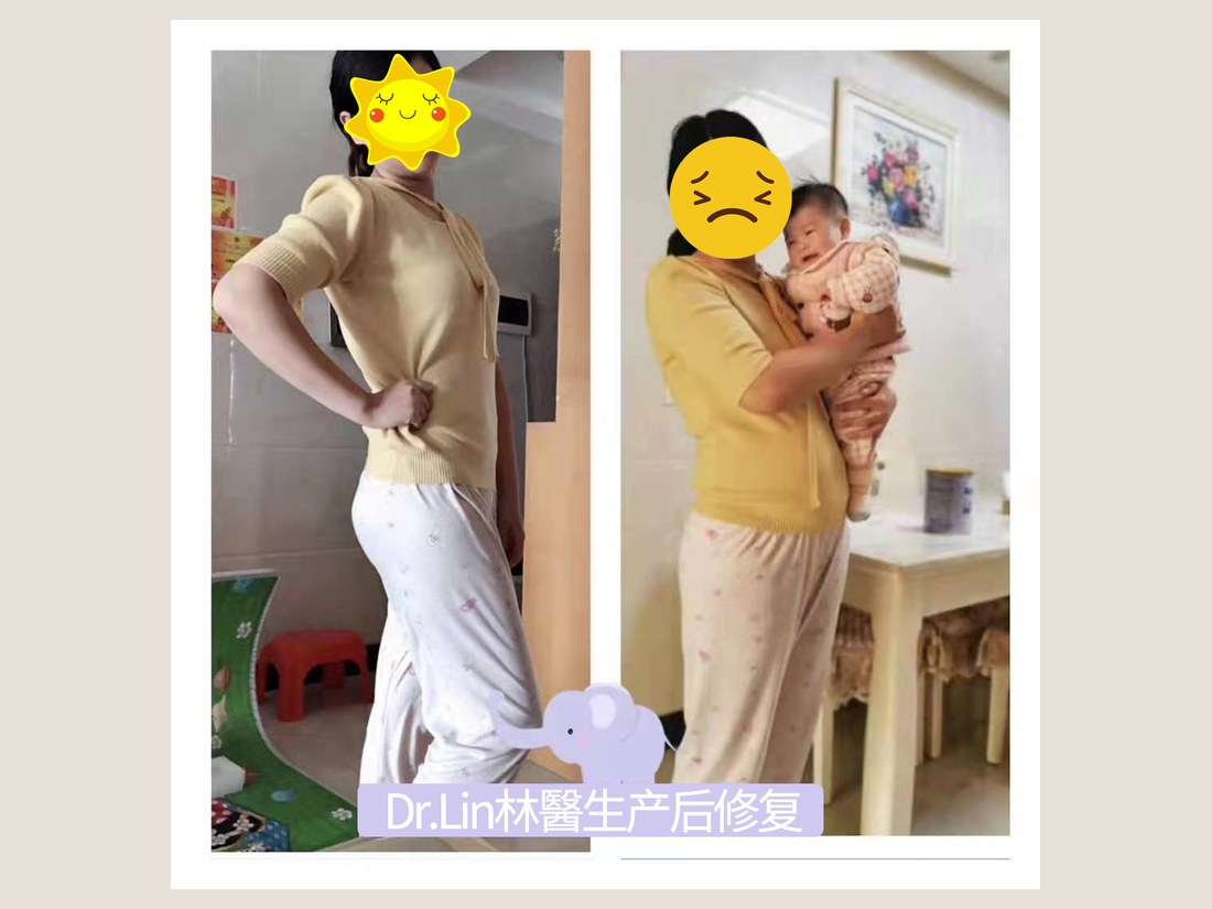 身材管理科部客户案例:体态管理记录