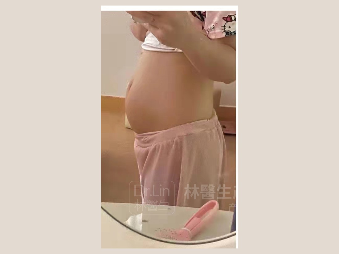 身材管理科部客户案例:腰腹状态实拍