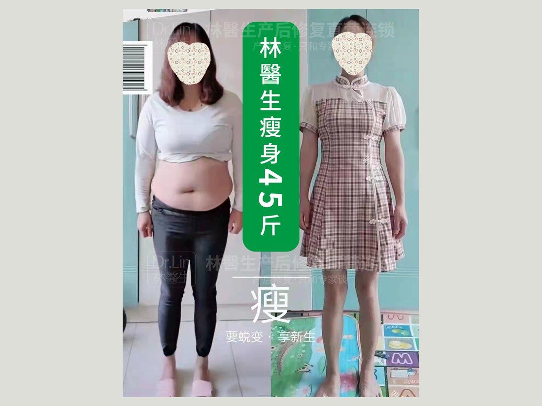 身材管理科部客户案例:瘦身 45 斤
