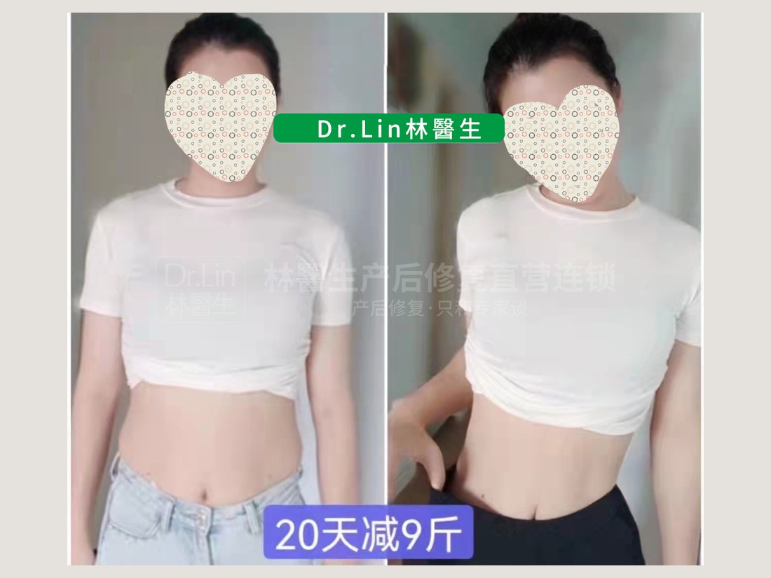 身材管理科部客户案例:20 天减 9 斤
