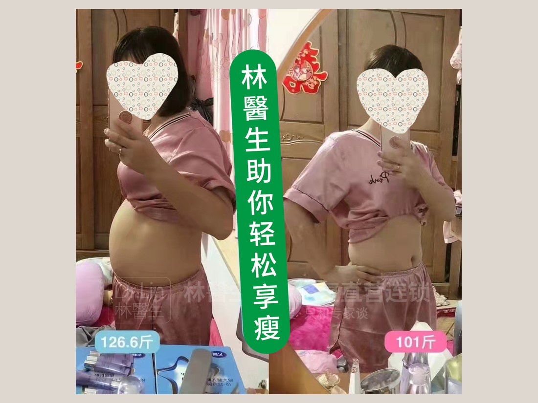 身材管理科部客户案例:轻松享瘦对照